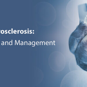 Scripps Cardiovascular Atherosclerosis Prediction, Prevention and Management 2021