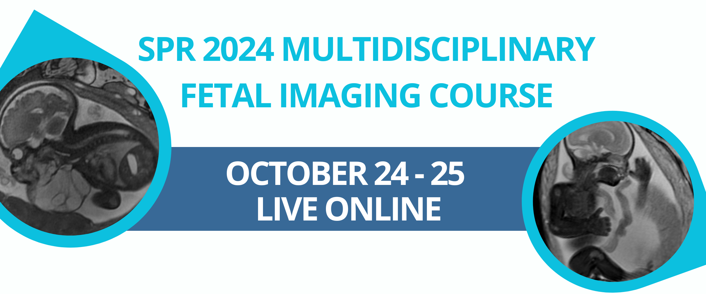 Society for Pediatric Radiology Multidisciplinary Fetal Imaging Course 2024