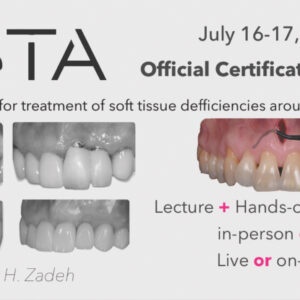VISTA Institute for Therapeutic Innovations Oral Plastic Surgery for Treatment of Soft Tissue Deficiencies Around Teeth & Implants 2022